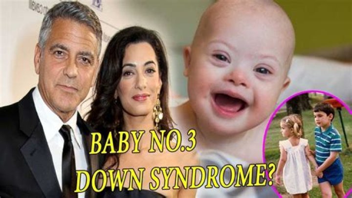 The Truth About George Clooney's Down's Syndrome Child
