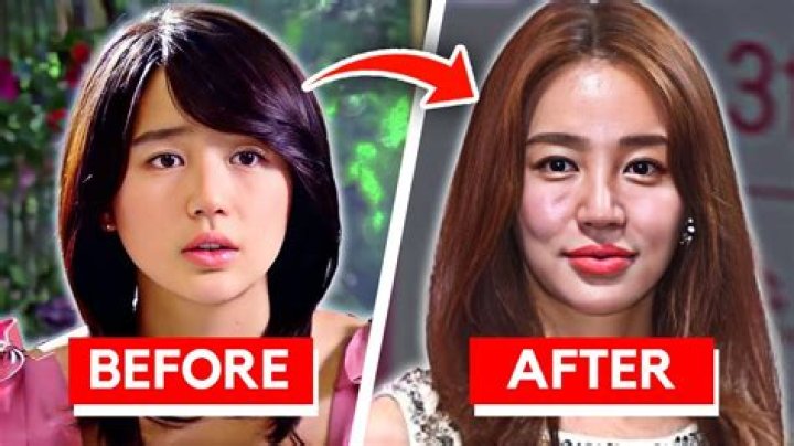 Unveiling The Truth Behind Kim Ji Won Plastic Surgery