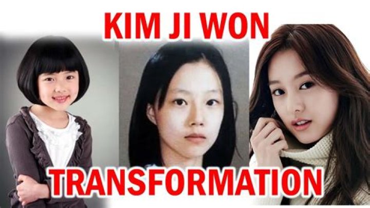 Unveiling The Truth Behind Kim Jiwon's Plastic Surgery Journey